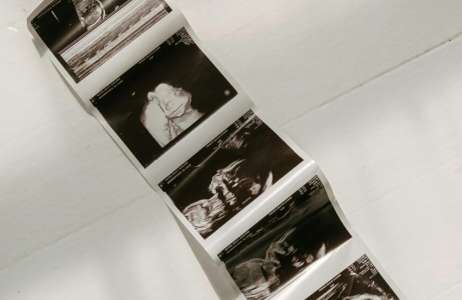 The Hidden Risks of Fertility Tourism