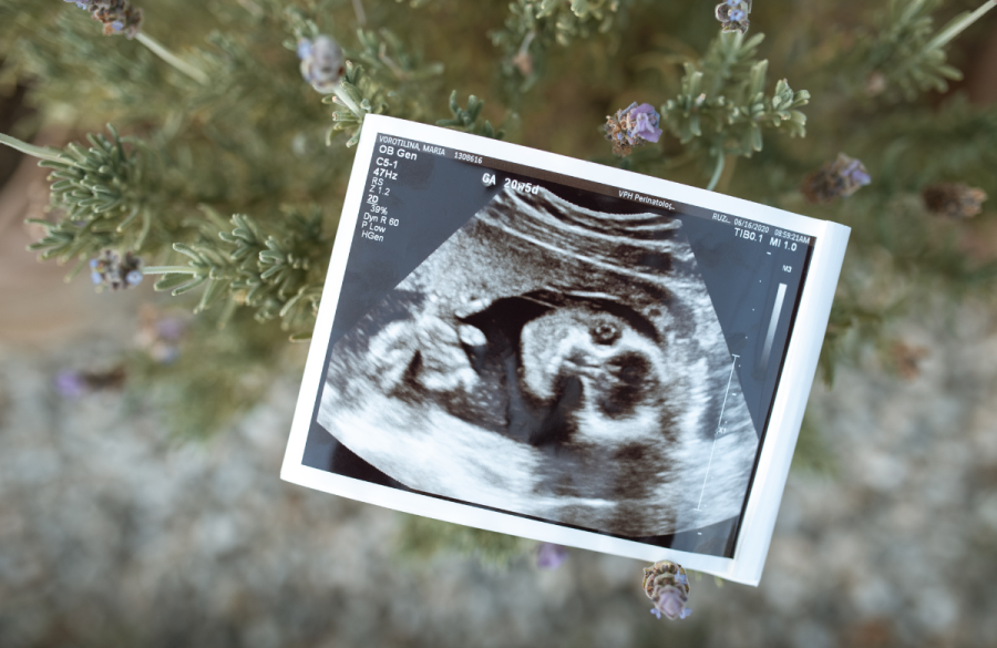 What is Posthumous Conception